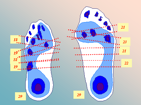Blueprint Poliomyelitis